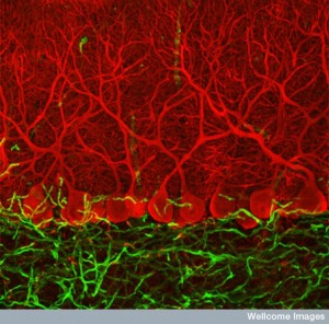 B0006224 Purkinje cells in the cerebellum Credit: Ludovic Collin. Wellcome Images images@wellcome.ac.uk http://wellcomeimages.org These specialised cells named Purkinje cells (red) are found in a part of the brain called the cerebellum. They send out vast numbers of branches that make connections with other cells in the cerebellum. This part of the brain co-ordinates your voluntary movements and keeps you oriented in space. It also plays a part in learning physical skills - like riding a bike or playing the piano. Confocal micrograph 2005 Published:  -  Copyrighted work available under Creative Commons by-nc-nd 4.0, see http://wellcomeimages.org/indexplus/page/Prices.html