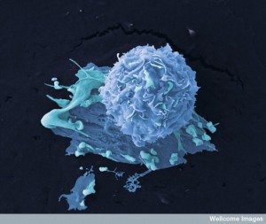 Intelligent Cancer Cells Communicate with Exosomes