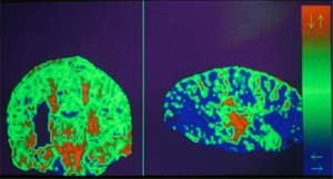 PD diffusion MRI