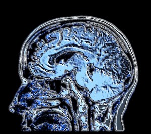 2D Mri Brain Image with 6mm Pituitary Tumor