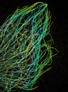 PD Microtubules_in_the_leading_edge_of_a_cell