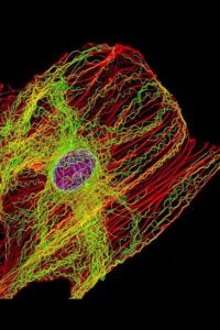 PD firbroblast microtubule green actin red