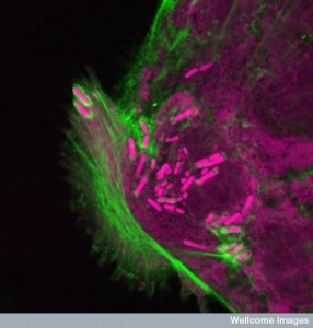 B0006238 Shigella infection