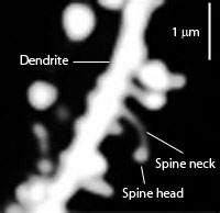 PD Dendritic_spines Feature