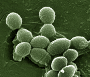 PD WIK Enterococcus_faecalis_SEM_01_Detail