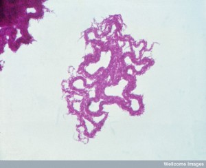 N0013794 Mycobacterium tuberculosis
