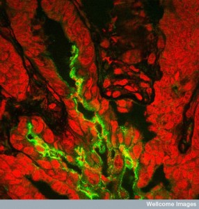 B0004970 Bacteria infecting the colon