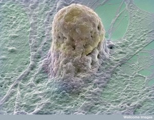 B0006219 Human embryonic stem cell