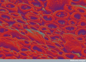 B0006713 Myelinated nerve fbres