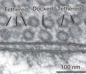 Tethered vesicles crop JPEG