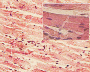 From Tilifa Ocaufa