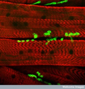 B0007258 Neuromuscular junction