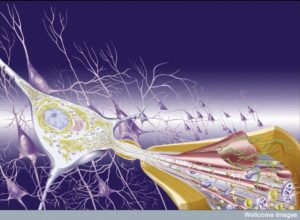 N0021139 Illustration; the pathology of Alzheimer's Disease