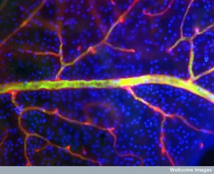 B0006226 Blood vessels in the retina