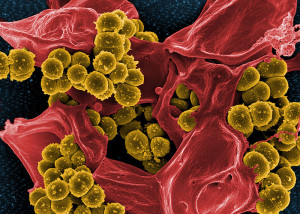 Jacopo Werther WIK BEAUTIFUL 800px-Scanning_electron_micrograph_of_Methicillin-resistant_Staphylococcus_aureus_(MRSA)_and_a_dead_Human_neutrophil_-_NIAID