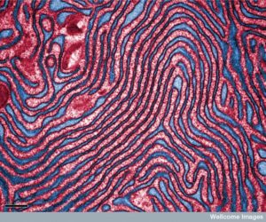 B0008518 Rough endoplasmic reticulum