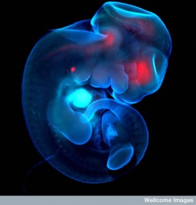 B0008303 Mouse embryo showing pancreas