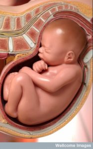 C0021943 Foetus in womb