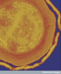 B0008377 Clostridium difficile