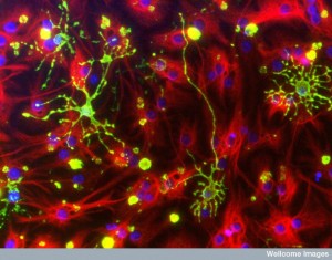 B0006512 Astrocytes and oligodendrocytes from neural stem cells